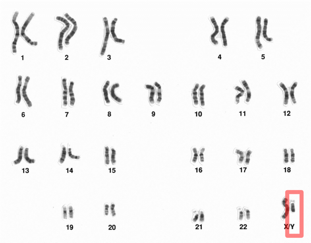 Y chromosome - Wikipedia