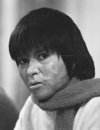 Carmen Gloria Quintana in 1987